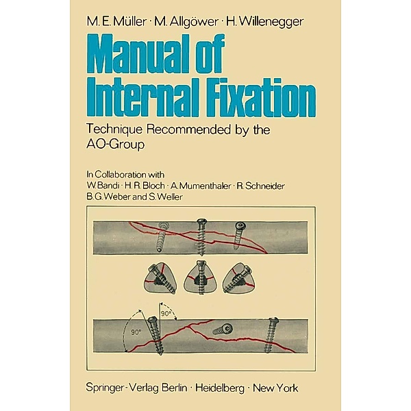Manual of Internal Fixation, M. E. Müller, M. Allgöwer, H. Willenegger