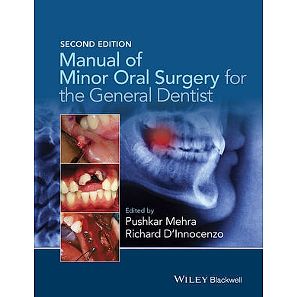 Manual of Minor Oral Surgery for the General Dentist, Pushkar Mehra, Richard D'Innocenzo