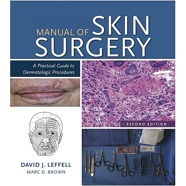 Manual of Skin Surgery, Md David J. Leffell, Md Marc D. Brown