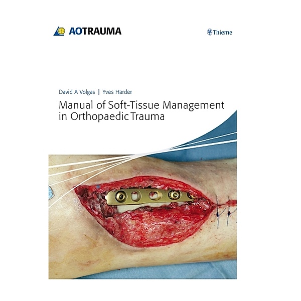 Manual of Soft-Tissue Management in Orthopaedic Trauma, Yves Harder, David A. Volgas