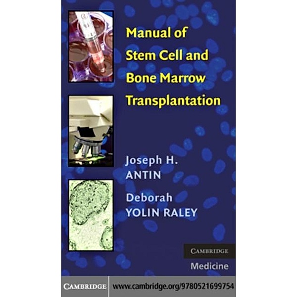 Manual of Stem Cell and Bone Marrow Transplantation, Joseph H. Antin