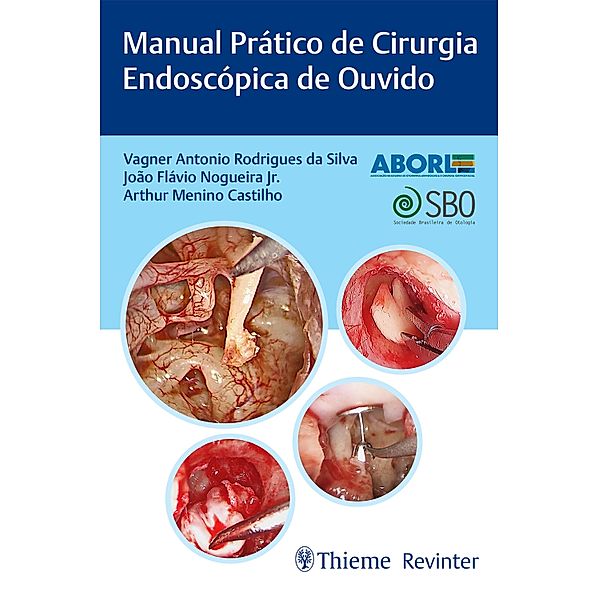 Manual Prático de Cirurgia Endoscópica de Ouvido, Vagner Antonio Rodrigues da Silva, João Flávio Nogueira Jr., Arthur Menino Castilho