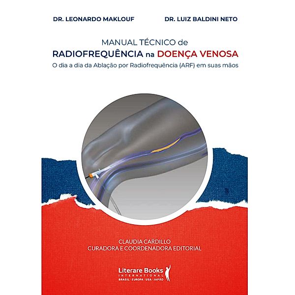 Manual técnico de radiofrequência na doença venosa, Leonardo Chadad Maklouf, Luiz Baldini Neto, Claudia Cardillo