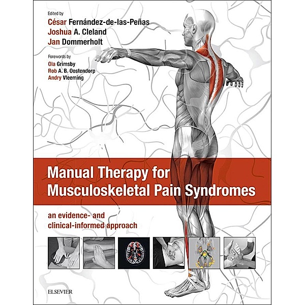 Manual Therapy for Musculoskeletal Pain Syndromes