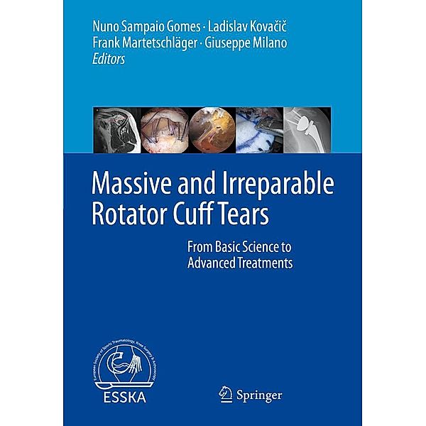 Massive and Irreparable Rotator Cuff Tears