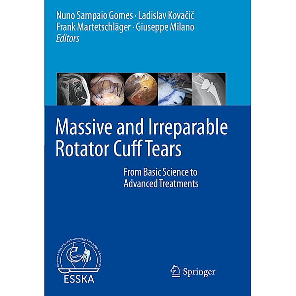 Massive and Irreparable Rotator Cuff Tears