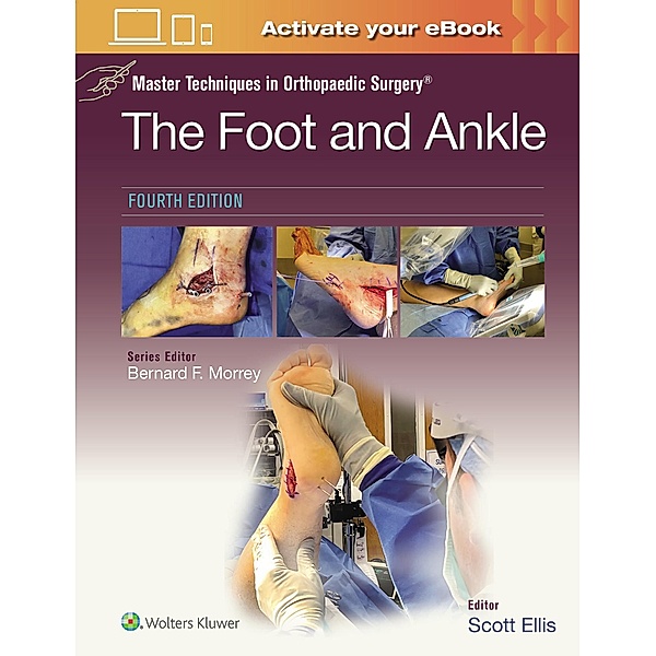 Master Techniques in Orthopaedic Surgery: The Foot and Ankle: Print + eBook with Multimedia, Scott Ellis