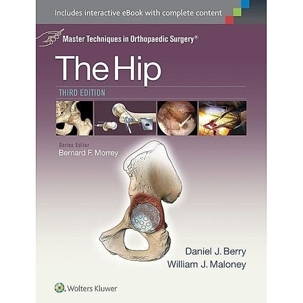 Master Techniques in Orthopaedic Surgery: The Hip, Daniel, J. Berry