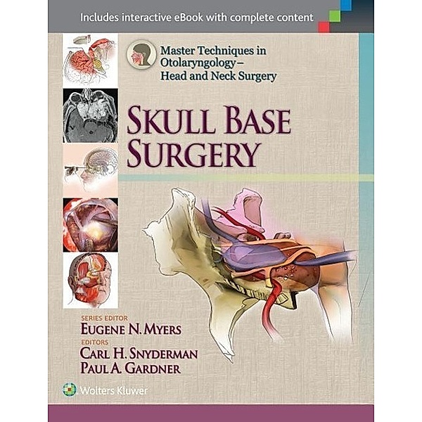 Master Techniques in Otolaryngology - Head and Neck Surgery: Skull Base Surgery, Carl H. Snyderman