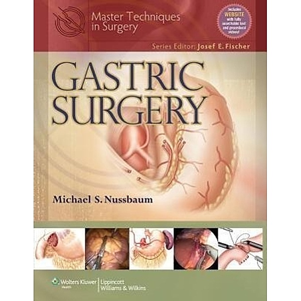 Master Techniques in Surgery: Gastric Surgery, Michael,S. Nussbaum