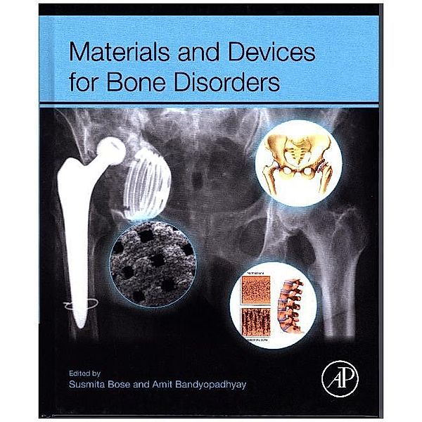 Materials and Devices for Bone Disorders, Susmita Bose