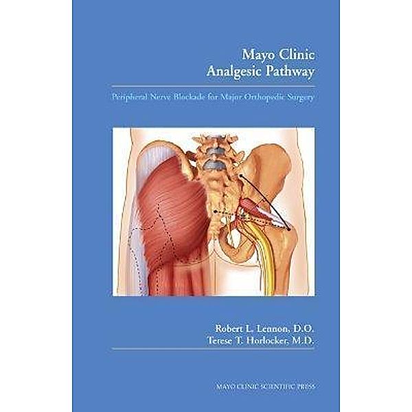 Mayo Clinic Analgesic Pathway, Robert L. Lennon, Terese T. Horlocker