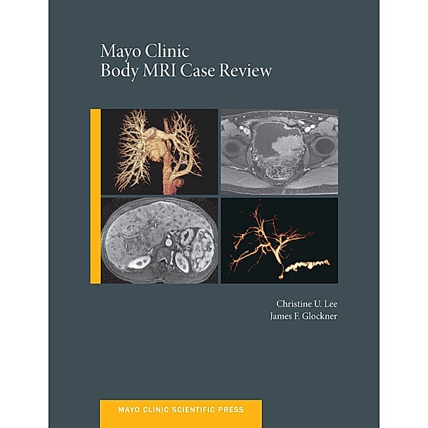 Mayo Clinic Body MRI Case Review, Christine U. C. Lee, James Glockner