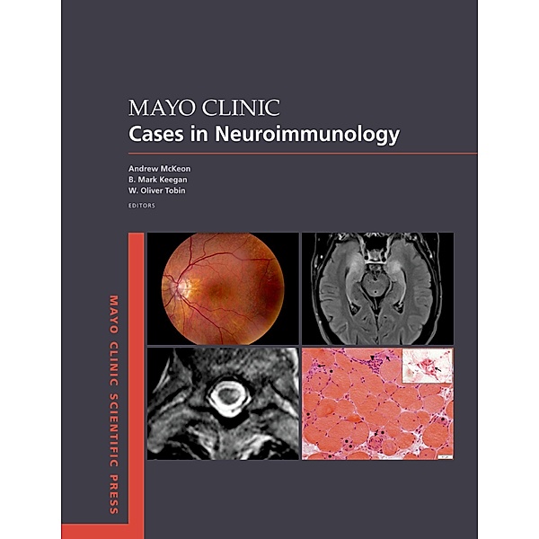 Mayo Clinic Cases in Neuroimmunology, Andrew McKeon, B. Mark Keegan, W. Oliver Tobin