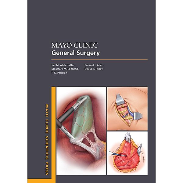 Mayo Clinic General Surgery, Jad M. Abdelsattar, Moustafa M. El Khatib, T. K. Pandian, Samuel J. Allen, David R. Farley