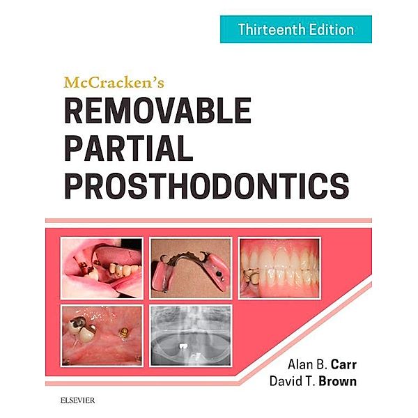 McCracken's Removable Partial Prosthodontics, Alan B. Carr, David T. Brown