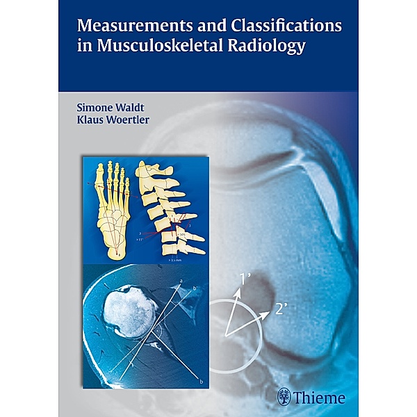 Measurements and Classifications in Musculoskeletal Radiology, Simone Waldt, Klaus Wörtler