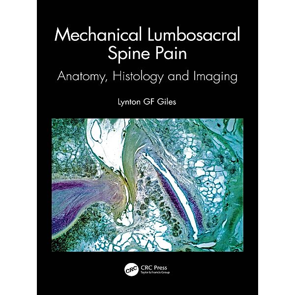 Mechanical Lumbosacral Spine Pain, Lynton Gf Giles