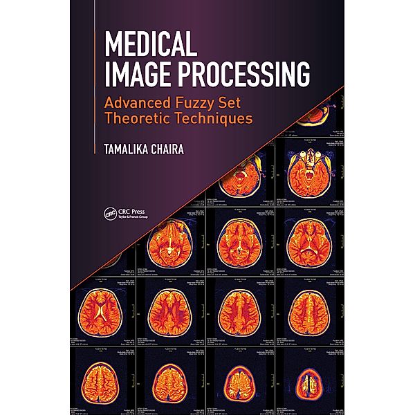 Medical Image Processing, Tamalika Chaira