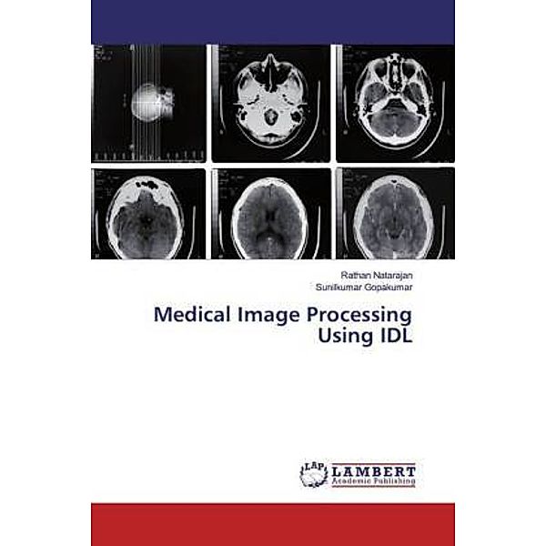 Medical Image Processing Using IDL, Rathan Natarajan, Sunilkumar Gopakumar