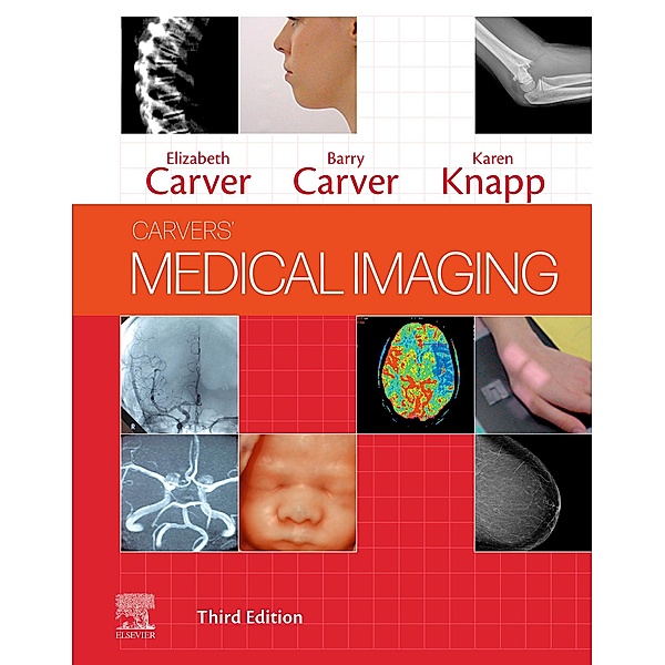 Medical Imaging - E-Book, Elizabeth Carver, Barry Carver, Karen Knapp