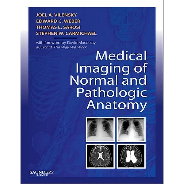 Medical Imaging of Normal and Pathologic Anatomy E-Book, Joel A. Vilensky, Edward C. Weber, Stephen W. Carmichael, Thomas Sarosi