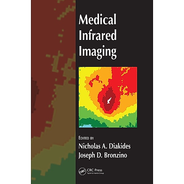 Medical Infrared Imaging, Nicholas A. Diakides, Joseph D. Bronzino
