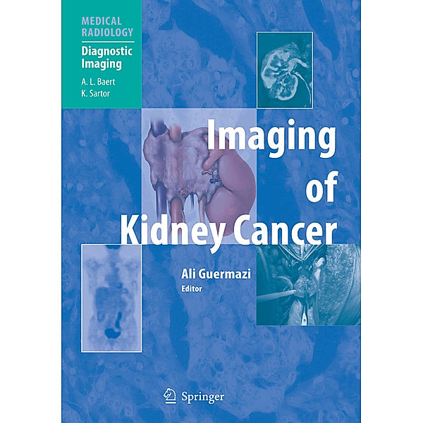 Medical Radiology / Imaging of Kidney Cancer