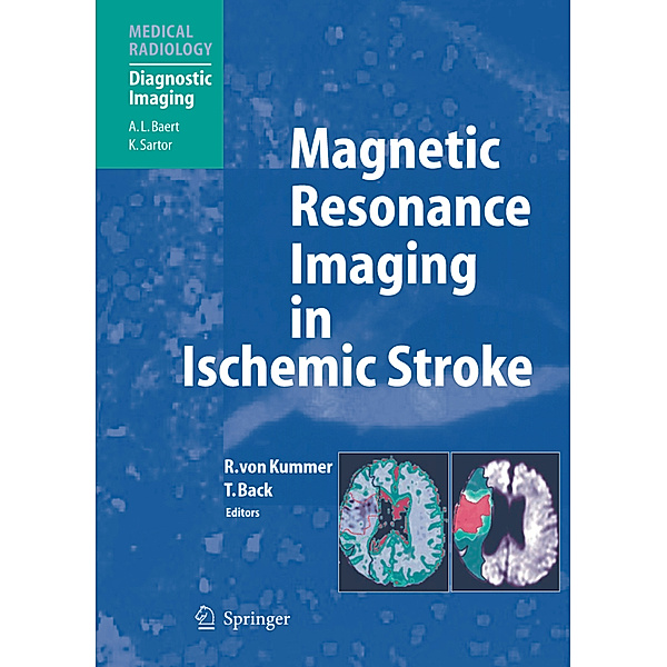 Medical Radiology / Magnetic Resonance Imaging in Ischemic Stroke
