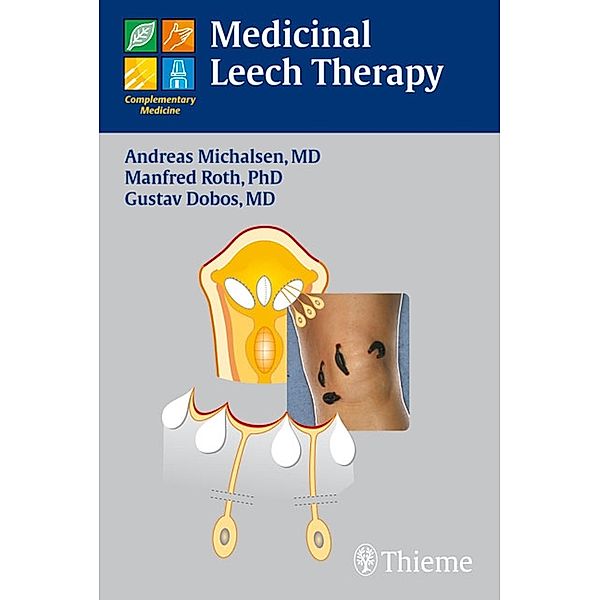 Medicinal Leech Therapy, Gustav Dobos, Andreas Michalsen, Manfred Roth