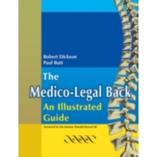 Medico-Legal Back: An Illustrated Guide, Robert A. Dickson