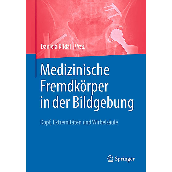 Medizinische Fremdkörper in der Bildgebung