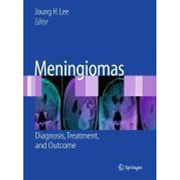 Meningiomas