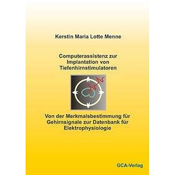 Menne, K: Computerassistenz zur Implantation von Tiefenhirns, Kerstin Menne