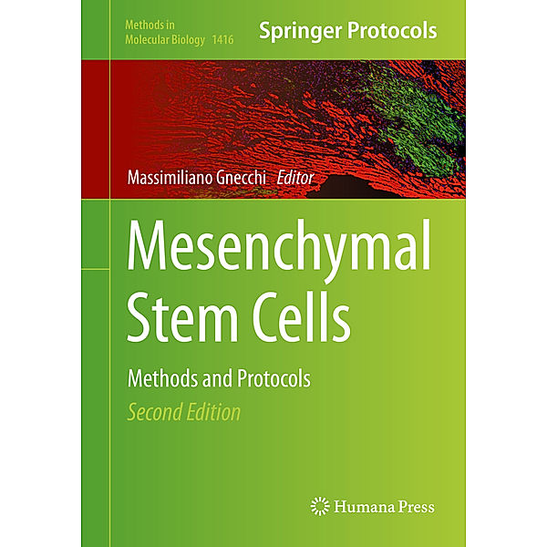 Mesenchymal Stem Cells