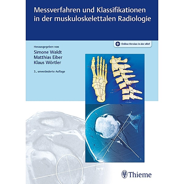 Messverfahren und Klassifikationen in der muskuloskelettalen Radiologie, Simone Waldt, Matthias Eiber, Klaus Wörtler