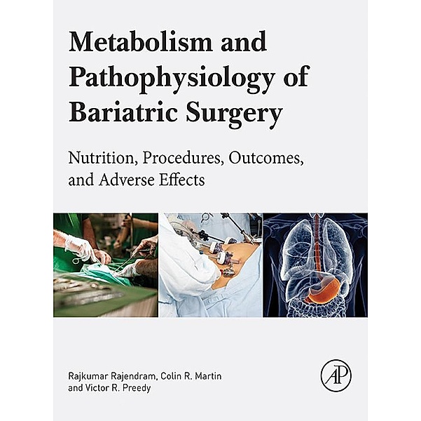 Metabolism and Pathophysiology of Bariatric Surgery