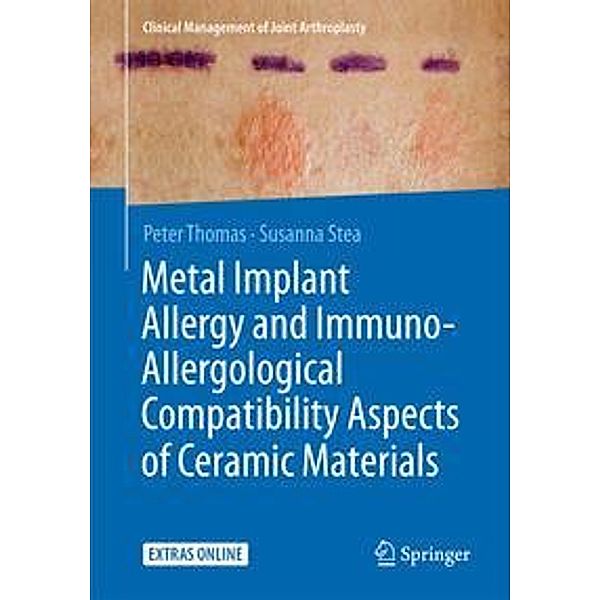 Metal Implant Allergy and Immuno-Allergological Compatibility Aspects of Ceramic Materials, Peter Thomas