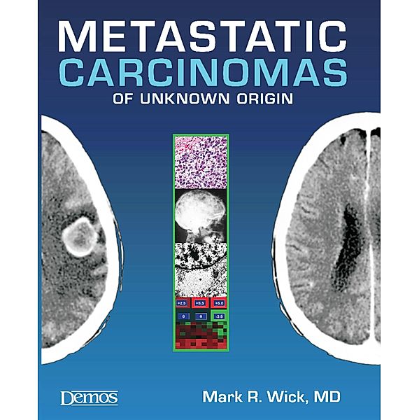 Metastatic Carcinomas of Unknown Origin, Mark R. Wick