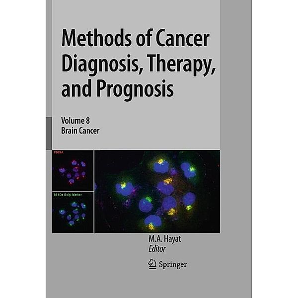 Methods of Cancer Diagnosis, Therapy, and Prognosis / Methods of Cancer Diagnosis, Therapy and Prognosis Bd.8