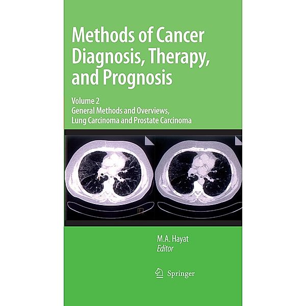 Methods of Cancer Diagnosis, Therapy and Prognosis / Methods of Cancer Diagnosis, Therapy and Prognosis Bd.2