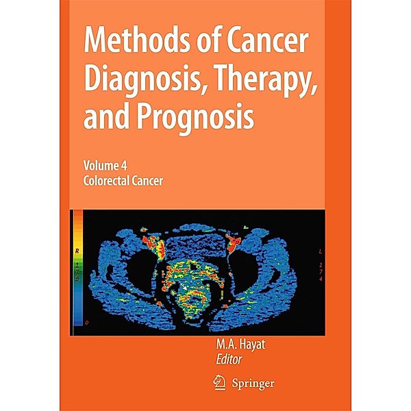 Methods of Cancer Diagnosis, Therapy and Prognosis / Methods of Cancer Diagnosis, Therapy and Prognosis Bd.4