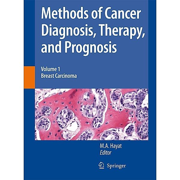 Methods of Cancer Diagnosis, Therapy and Prognosis / Methods of Cancer Diagnosis, Therapy and Prognosis Bd.1