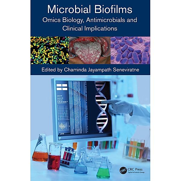 Microbial Biofilms