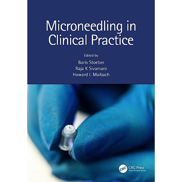 Microneedling in Clinical Practice