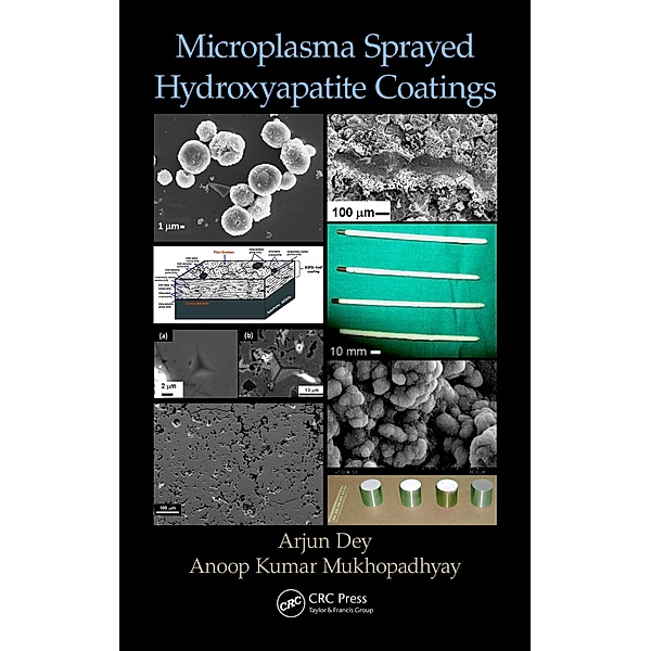 Microplasma Sprayed Hydroxyapatite Coatings, Arjun Dey, Anoop Kumar Mukhopadhyay