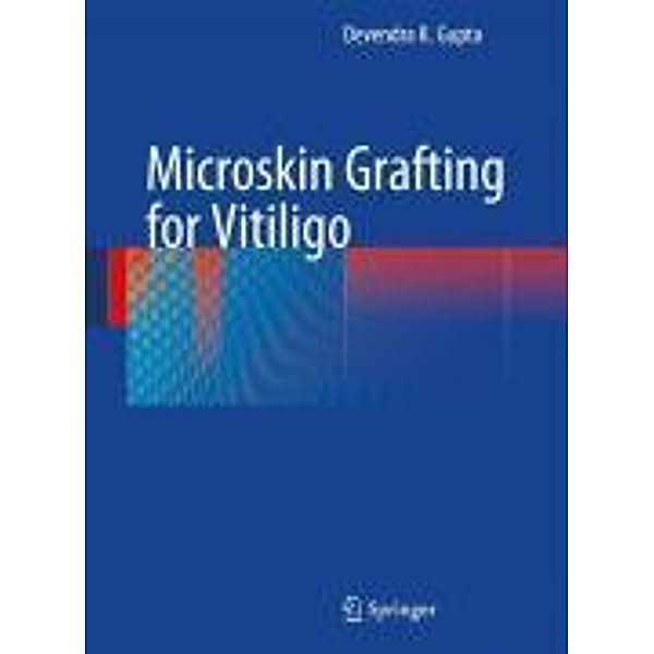Microskin Grafting for Vitiligo, Devendra K. Gupta