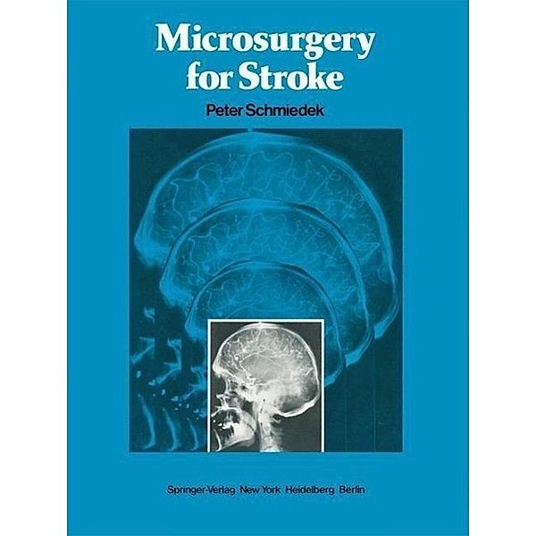 Microsurgery for Stroke