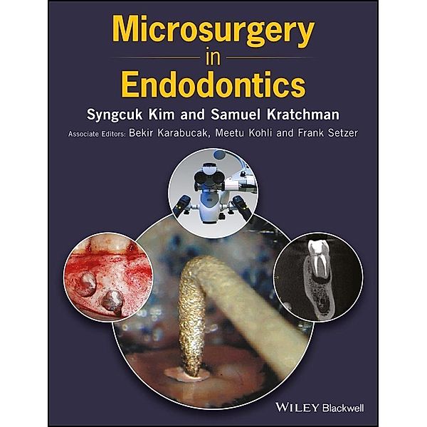 Microsurgery in Endodontics