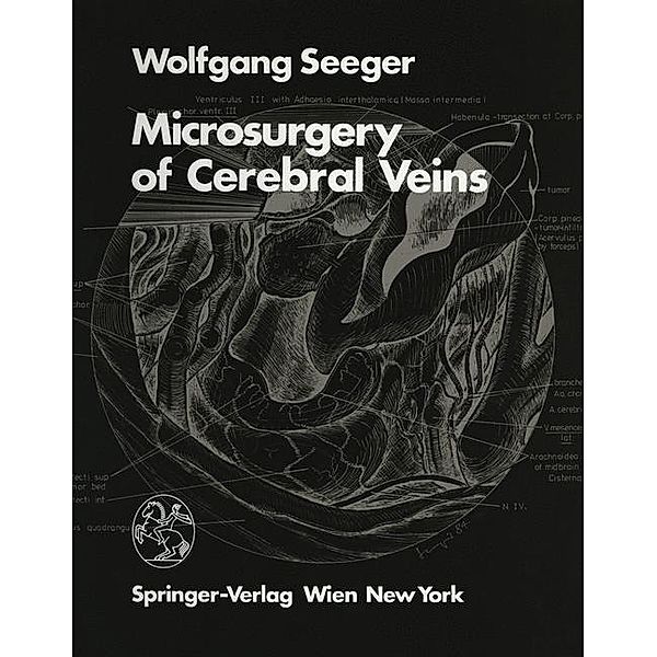 Microsurgery of Cerebral Veins, W. SEEGER